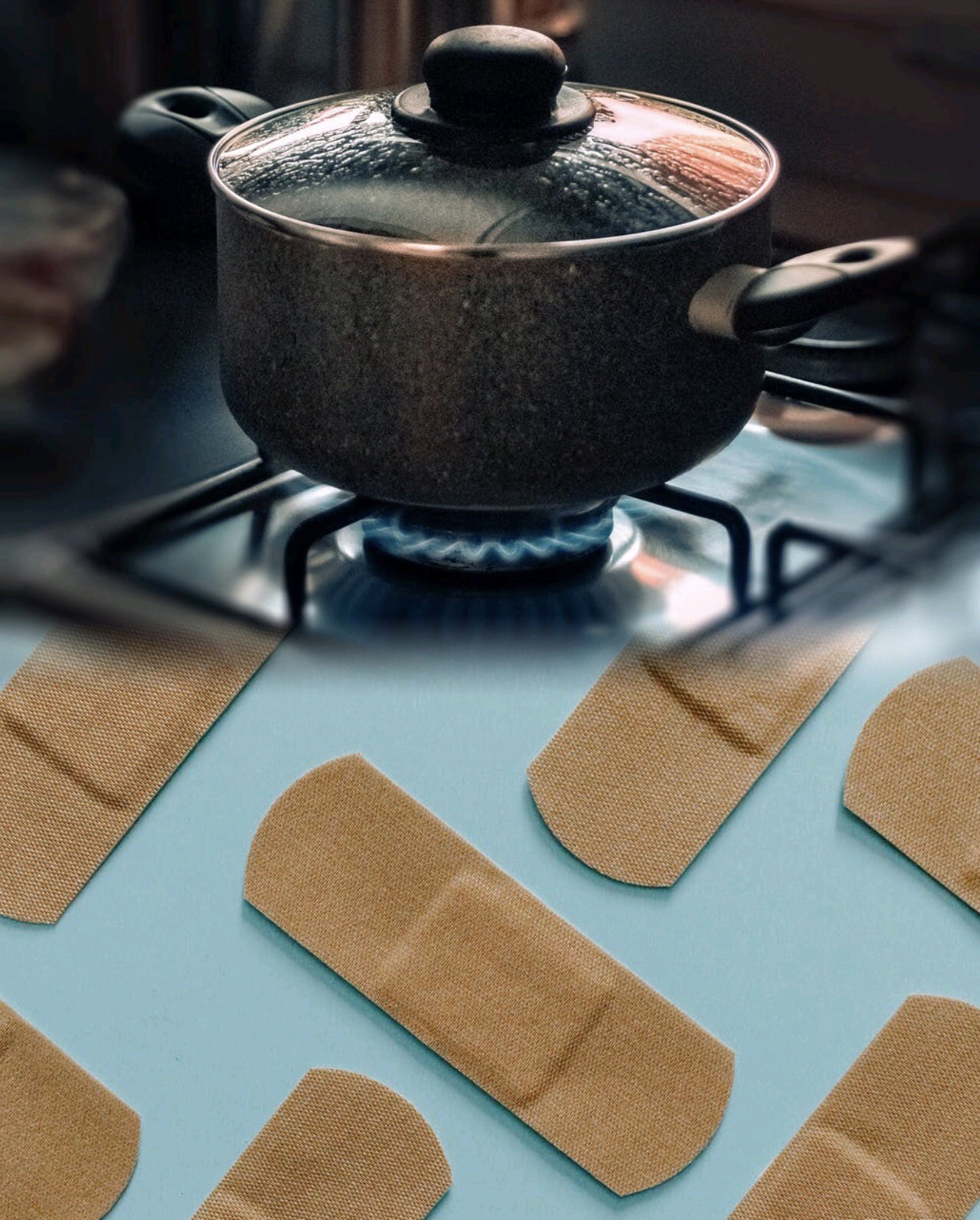 What to Put on a Burn I Survived the Kitchen and So Can You